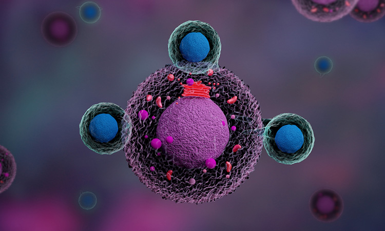 mesothelioma and adenocarcinoma