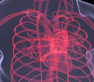 CARDIS cardio-vascular disease