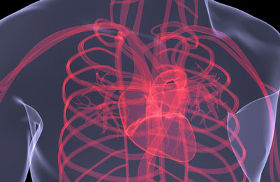 CARDIS cardio-vascular disease