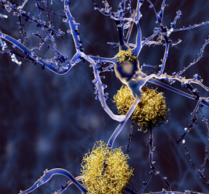 Webinar: Phenotypic assays for CNS disease drug discovery