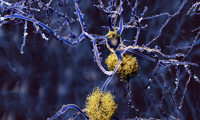 Webinar: Phenotypic assays for CNS disease drug discovery