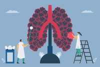 Chronic obstructive pulmonary disease or COPD. Give the new alveoli. Lung have breathing problems and poor airflow. Vector illustration in flat design.