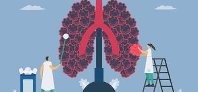 Chronic obstructive pulmonary disease or COPD. Give the new alveoli. Lung have breathing problems and poor airflow. Vector illustration in flat design.