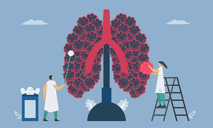 Chronic obstructive pulmonary disease or COPD. Give the new alveoli. Lung have breathing problems and poor airflow. Vector illustration in flat design.