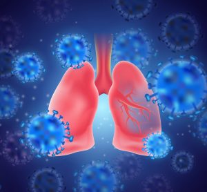 cartoon of blue coronavirus particles surrounding pink human lungs - idea of SARS-CoV-2 lung pathology