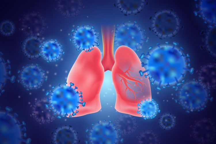 cartoon of blue coronavirus particles surrounding pink human lungs - idea of SARS-CoV-2 lung pathology