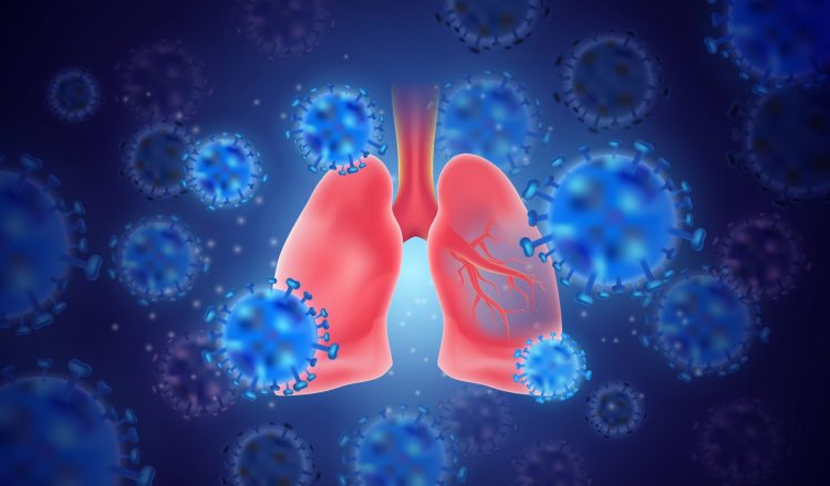 cartoon of blue coronavirus particles surrounding pink human lungs - idea of SARS-CoV-2 lung pathology