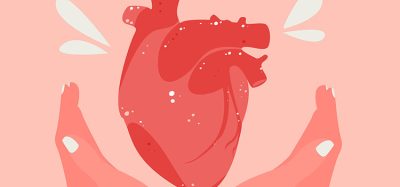 CVD
