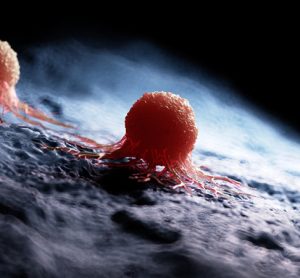 Cancer cells