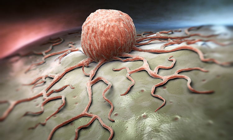Cancer cell and immunotherapy