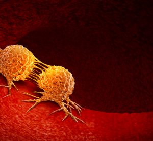 Cancer cells
