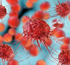 Cancer cells