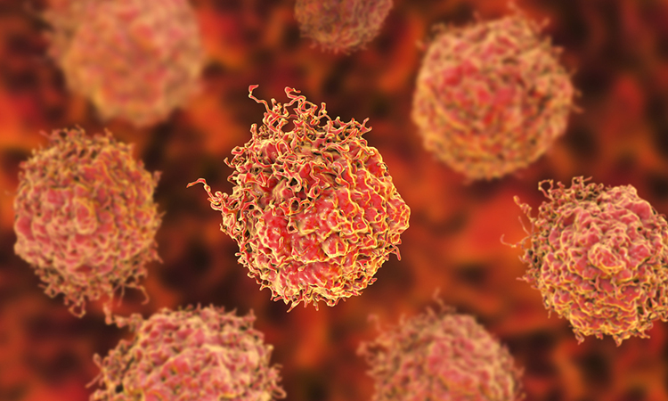 Radiopharmaceuticals And Nanoparticles Used To Kill Cancer Cells