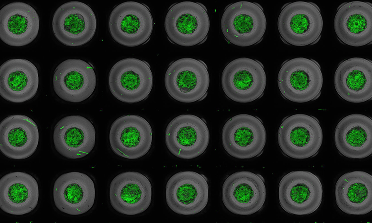 Cardiac organoids