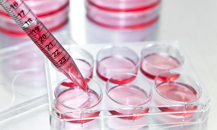 Cell-based assays