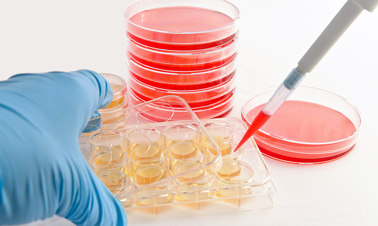 Cell lines