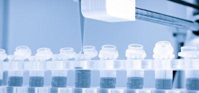 Cell therapy - Cellistic