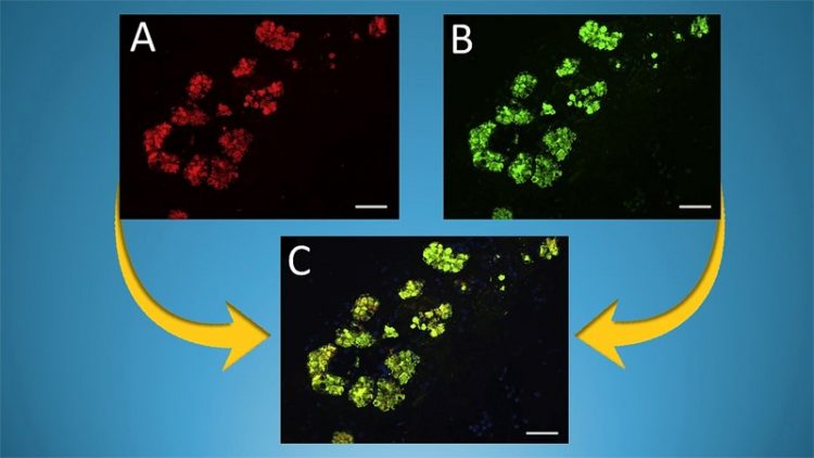 Cells from submucosal glands are stained red in A to identify the mystery ligand (a small molecule that binds to a protein to carry out a biological function) for the Siglec-8 protein and green in B for the DMBT1 protein. Overlaying the two images in C shows that the unknown molecule is an isoform (a natural variation) of DMBT1. The scale bar in the lower right corner is 50μm [Credit: Ronald Schnaar, Johns Hopkins Medicine].