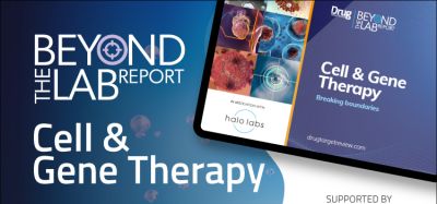 Beyond the Lab Cell Therapy