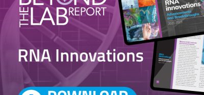 Beyond the lab RNA