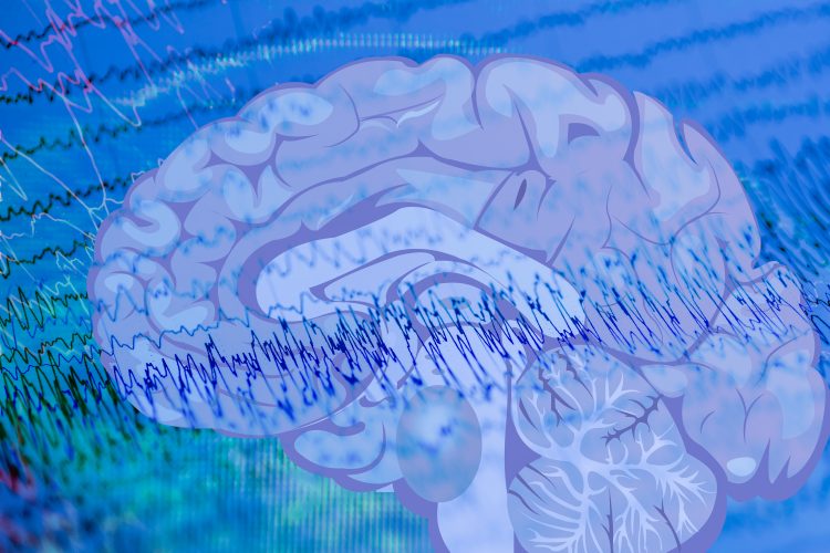 EEG waves indicating an epileptic seizure overlaid with a brain