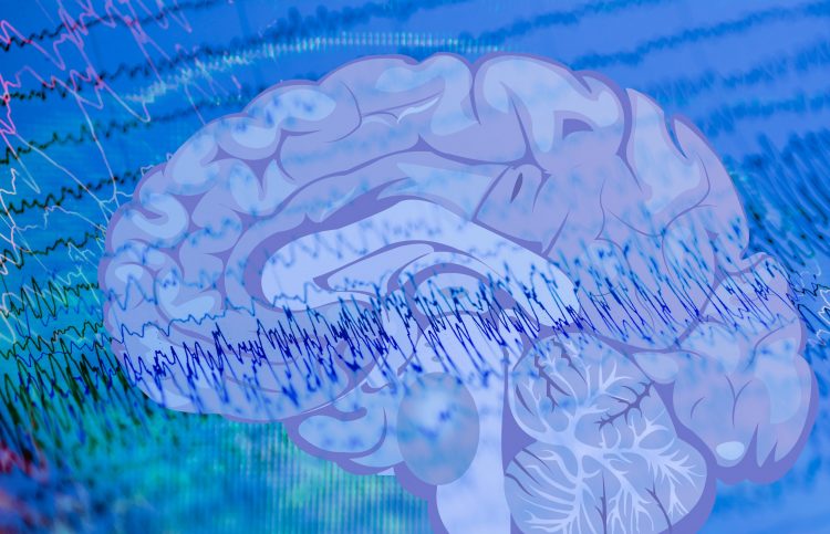 EEG waves indicating an epileptic seizure overlaid with a brain