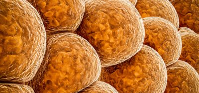Metabolic fat cells