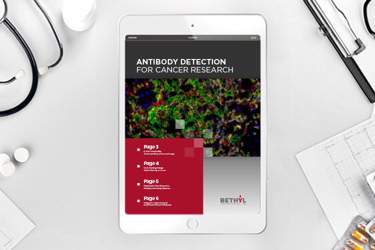 ebook: Antibody detection for cancer research