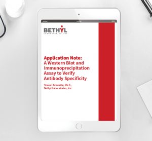 Application note: Western blot & IP assay to verify antibody specificity