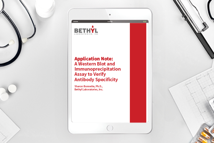 Application note: Western blot & IP assay to verify antibody specificity