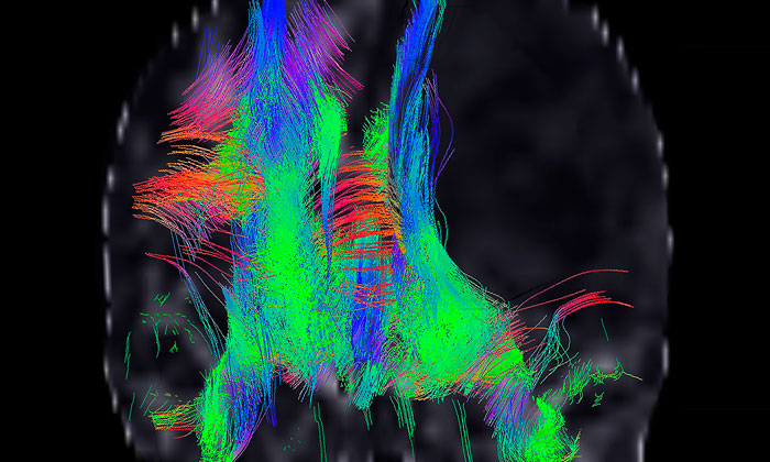 Bailey article phenotypic screening