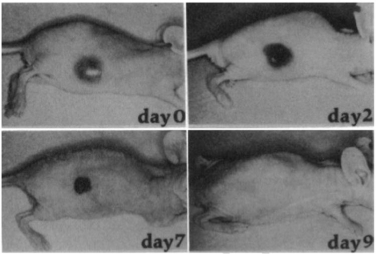 Figure 2: Vascular targeted therapies induce tumour necrosis. Gross appearance of a subcutaneous neuroblastoma tumour treated with a MHC class II targeted immunotoxin. At day 0 the tumours appear highly vascular. Two days after treatment, the tumour is blackened (indicating massive intratumoural haemorrhage). At day 7 the tumour has collapsed into a scab-like plug and by day 10 there is no visible living tumour (figure adapted from 19)