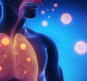 Flu in the lungs