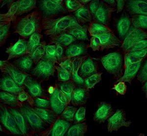 Imaging of cancer cells