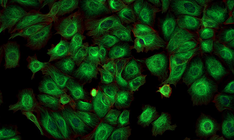 Imaging of cancer cells