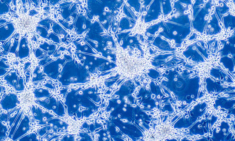 Glioblastoma cells