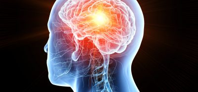 pictur of a red brain within the human anatomy with a glowing red mass indicating a brain tumour