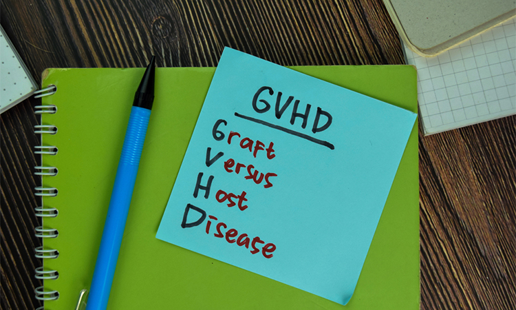 GVHD - Graft Versus Host Disease write on notes isolated on Wooden Table.