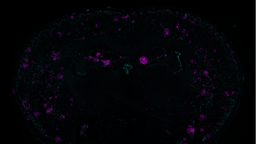 Image: a mouse-brain cross section shows a marker of double-stranded breaks in teal and the immune system cytokine Cxcl10 in magenta.