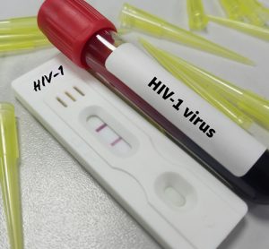 Test kit with blood sample for HIV-1 test, HIV screening test.