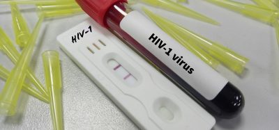 Test kit with blood sample for HIV-1 test, HIV screening test.