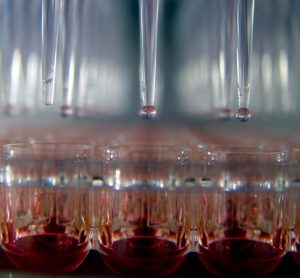 SARS-CoV-2 high-throughput screening