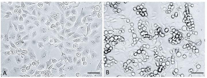 Pancreatic cancer cells in control (A) vs treatment by anti-sortilin targeting drug (B). When sortilin is targeted, pancreatic cancer cells partially lose attachment and cannot migrate. Scale bars = 50um [credit: Hubert Hondermarck's Laboratory].