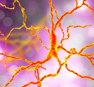 Huntington's disease