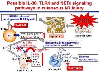 diagram showing role of IL-36 in wound healing