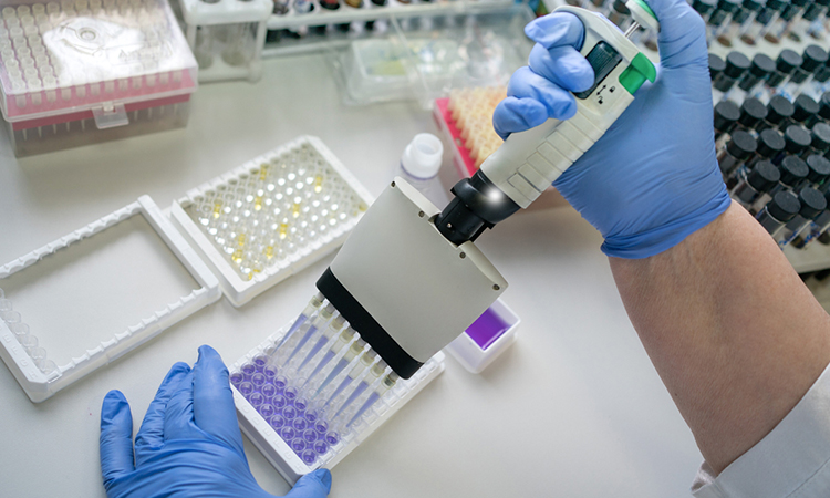 Immunoassays