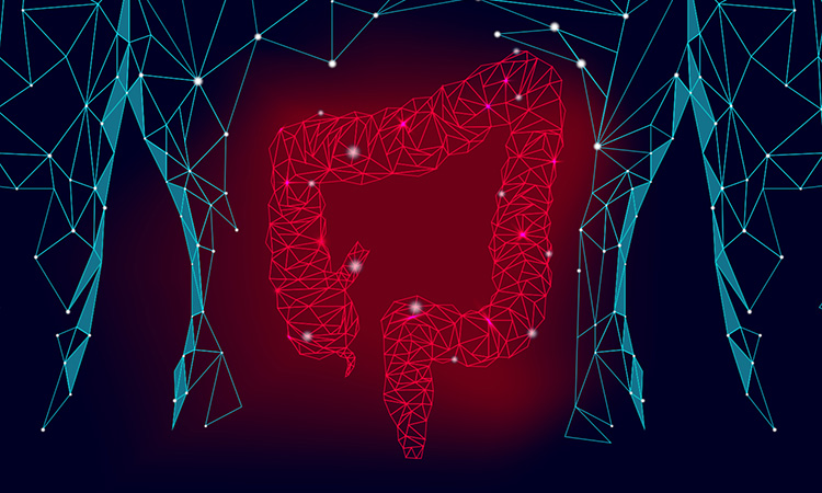 Intestinal organoids