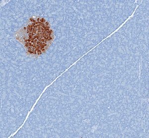 Islets and diabetes