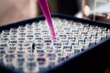 pipette containing pink liquid over an assay well plate