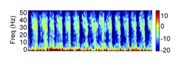 A multitaper spectrogram showing brain rhythms under ketamine anaesthesia